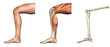 Anatomical Overlays - Bent Knee