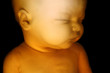 Fetus on Black