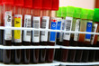 Blood Samples