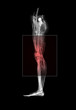 Knee Pain