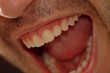 close up view of laughing mouth close up view of laughing mouth