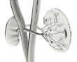 Kidney X-ray