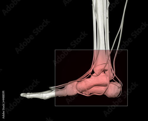 Illustration: Ankle Pain Ankle Pain