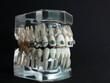 Dentalgebiss mit Speed-Bracket