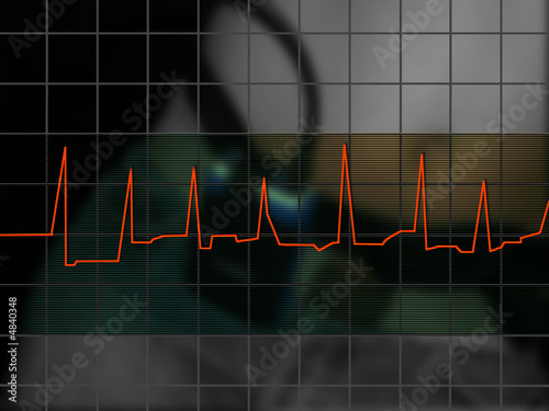 ekg ekg