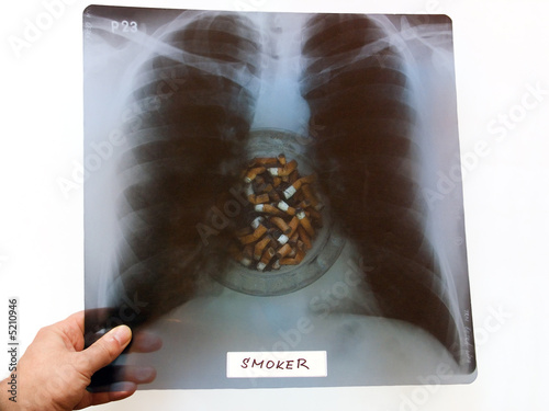 pneumonograph