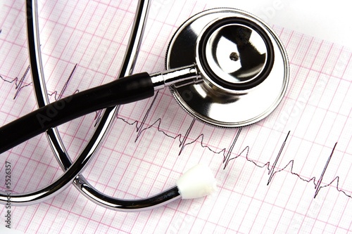 Photo: A stethoscope over a electrocardiogram close up. A stethoscope over a electrocardiogram close up.