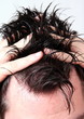 Haare