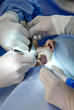champ opératoire au cours d'une chirurgie dentaire