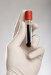 Photo: hand holding blood in test tube close up hand holding blood in test tube close up