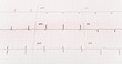 A 12 lead EKG or electrocardiogram with selective focus.