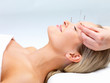 Photo: Acupuncture therapy - alternative medicine Acupuncture therapy - alternative medicine