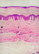 sweat gland LP sweat gland LP