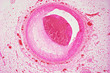 Coronary artery