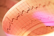 ECG print ECG print