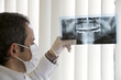 X-ray Teeth Diagnostics