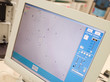 Monitor showing intra cytoplasmic sperm injection