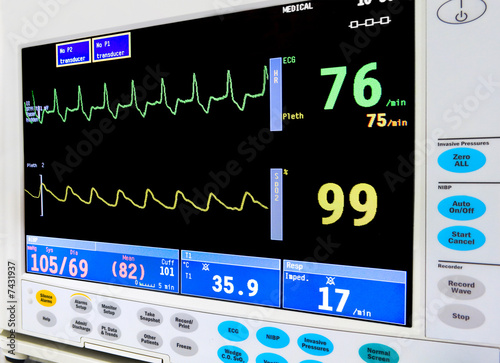 ICU cardiac monitor