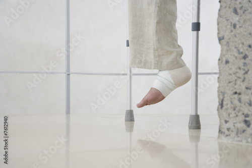 Photo: Man with Sprained Ankle Man with Sprained Ankle