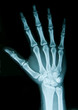 Radiografia della mano