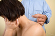 Acupuncture needles on back of a young woman Acupuncture needles on back of a young woman