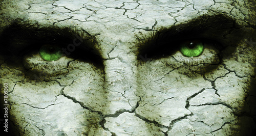 Photo: Cracked skin Cracked skin