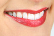 dents blanches