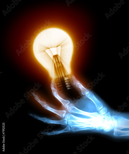 x ray hand. x-ray hand holding a bulb