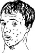 Illustration: spotty teenager spotty teenager