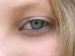 Foto: One eye One eye