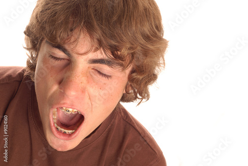 Photo: teenage boy having great big yawn with braces on his teeth teenage boy having great big yawn with braces on his teeth