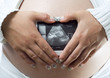 Pregnancy.
