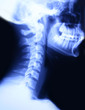 Skull and neck X-ray
