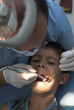Young boy is having his cavities fixed by a dentist