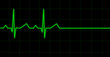 électrocardiogramme