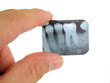 X-ray being examined by a dentist.