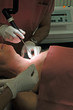 Operation mit Laser
