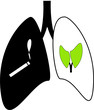 Poumon cigarette cancer