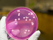 Bacterial colonies