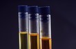 test tube