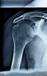 Xray