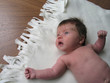Foto: young baby with a rash young baby with a rash