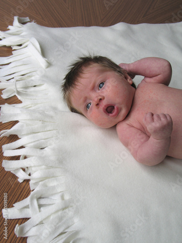 Photo: young baby with a rash young baby with a rash