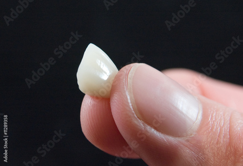 Photo: Tooth Crown Tooth Crown