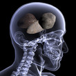 Skeleton X-Ray - Rocks In His Head