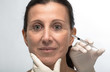 Cosmetic treatment with botox injection