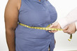 Doctor taking measures of overweight mid-adult woman