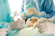 Operation