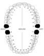 32 teeth