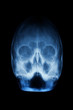 x-rays